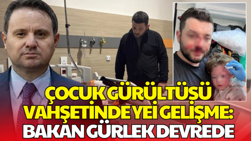 Yalova'da Baba ve 14 Aylık Kızı Darp Edildi! Bakan Gürlek'ten Açıklama Geldi